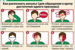 Признаки ишемического инсульта