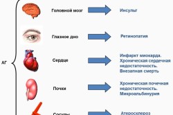 Последствия гипертонии