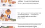 Какие бывают симптомы сердечного приступа?