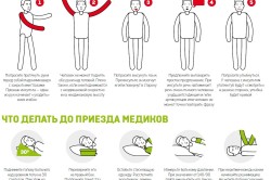 Первая помощь при инсульте