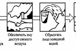 Первая помощь при потере сознания