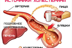 Источники холестирина