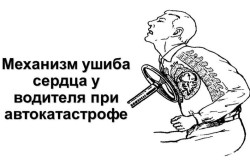 Боли при ушибе грудной клетки