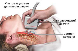 Диагностика атеросклероза головного мозга