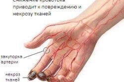 Особенности диеты при васкулите