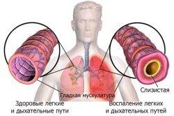 Возникла боль в грудине справа: причины образования
